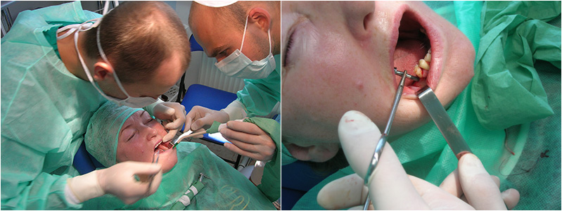Implanty, protetyka, ortodoncja, stomatologia, dentysta, Warszawa, Zacisze, Targówek